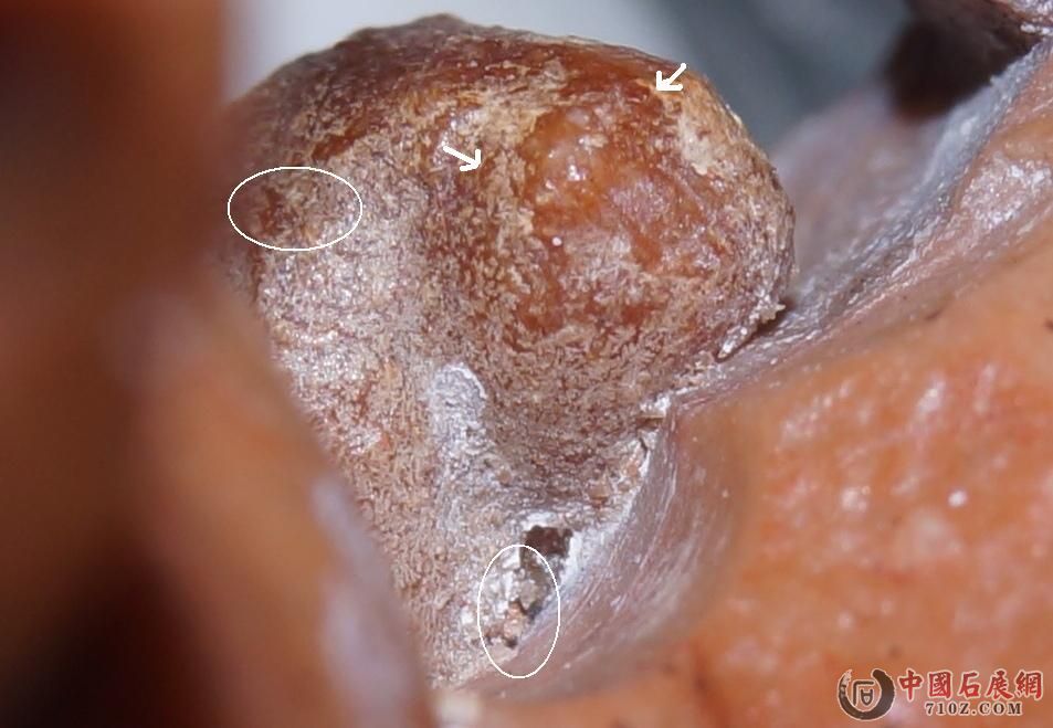 9. ˫��, �Ҽ���޽� & ��צ