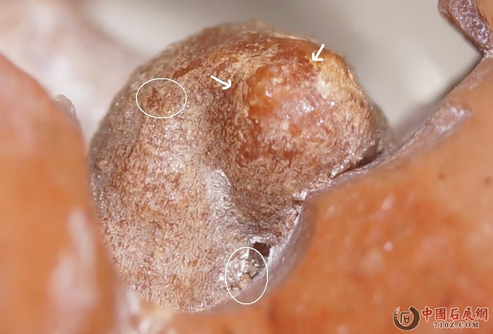 10. ˫��, �Ҽ���޽�& ��צ